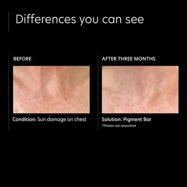 Pigment Bar PCA