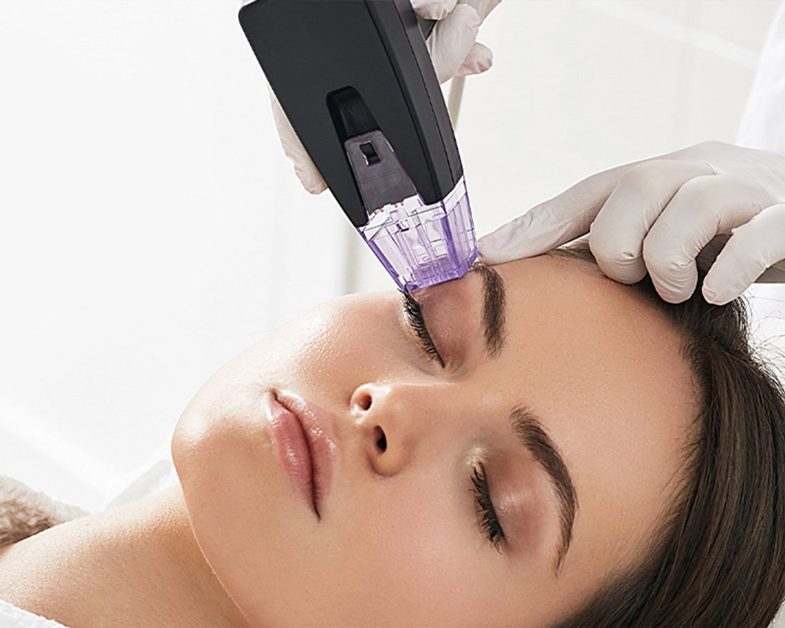 Radiant Revival: Morpheus8 Microneedling Treatment