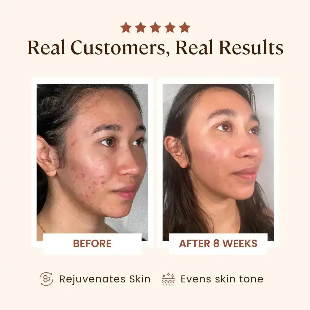 Plasma Skin Perfector one-year manufacturer warranty, from SkinSkulpt