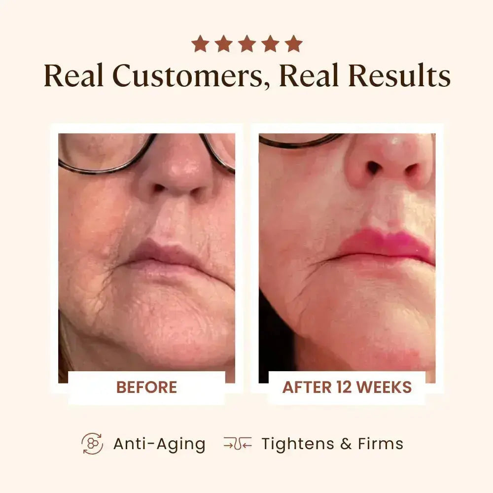 Real customer results with the SkinSkulpt Plasma Skin Perfector