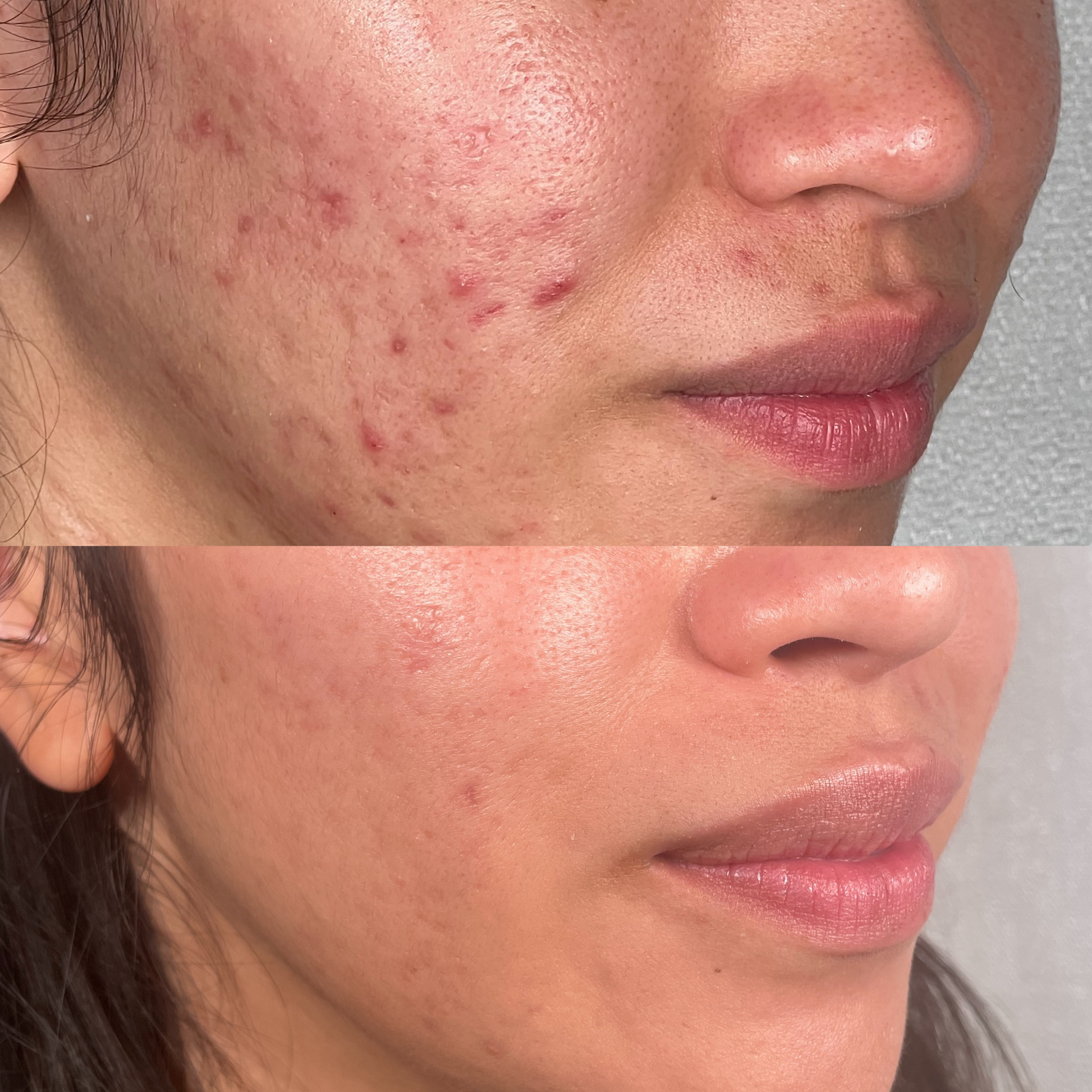 Skin Skulpt System Skin Skulpt