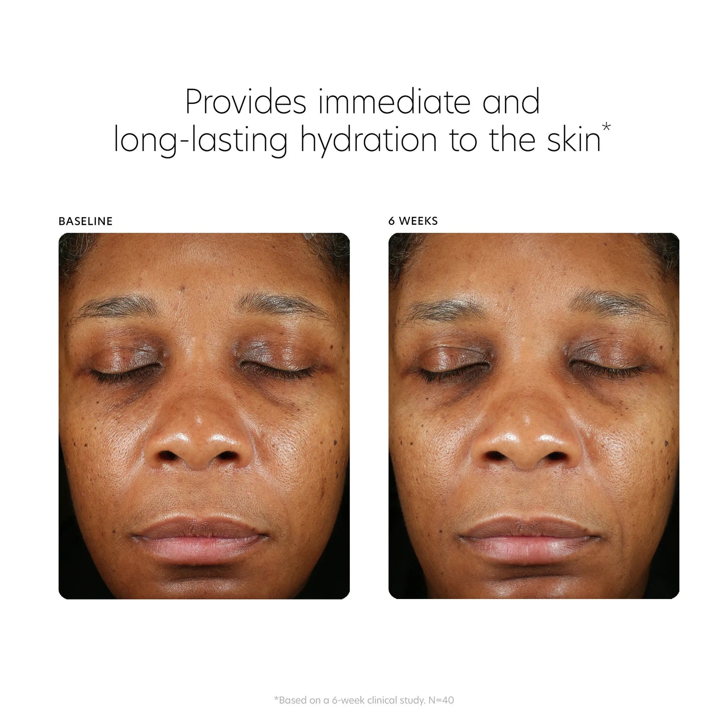 Hyaluronic Acid Boosting Serum PCA