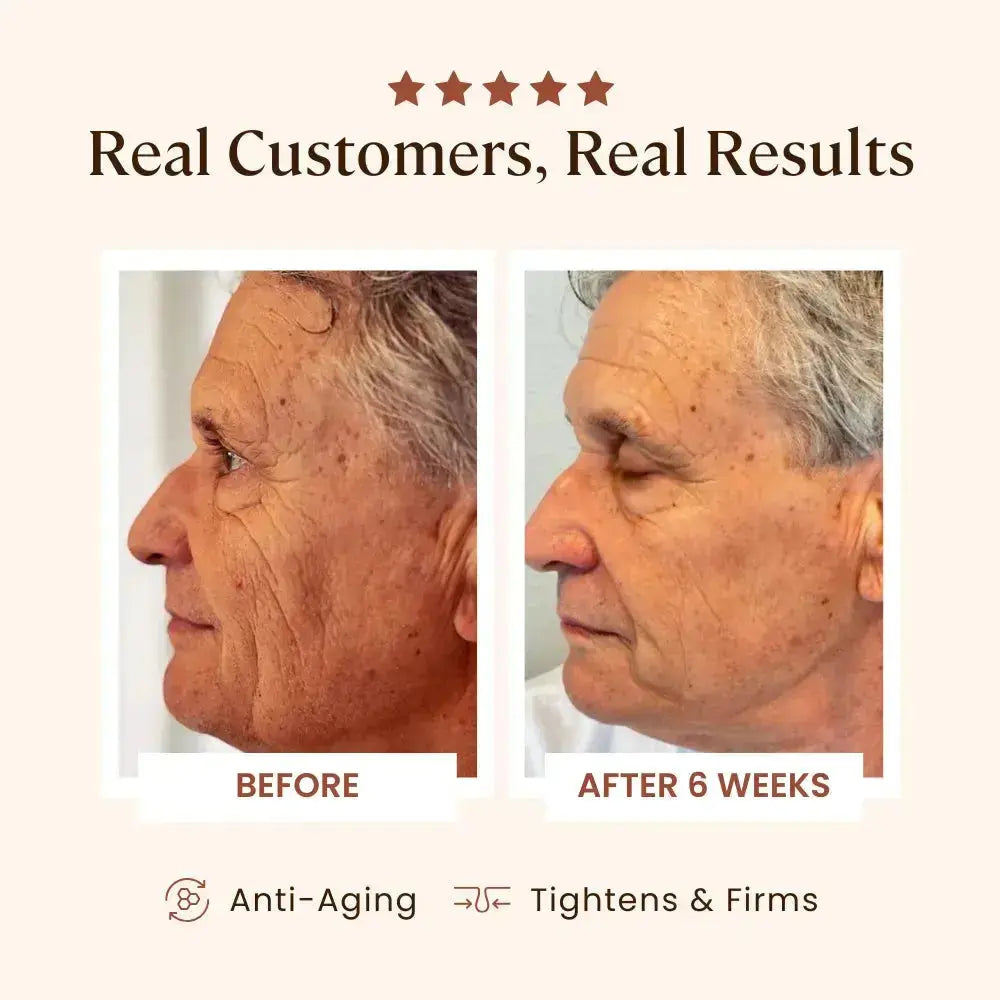 The before and after images of real customers using the Plasma Skin Perfector from Skin Skulpt. Useful for anti aging and tightening and firming skin