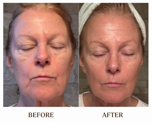 Before and after comparison of a woman's face with visible skin texture differences.